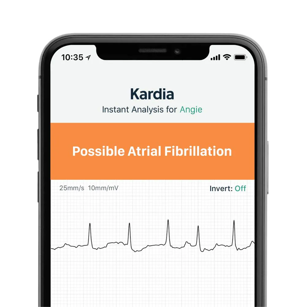 AliveCor KardiaMobile 6L | FDA-Cleared | Wireless 6-Lead EKG | Detects AFib or Normal Heart Rhythm in 30 Seconds