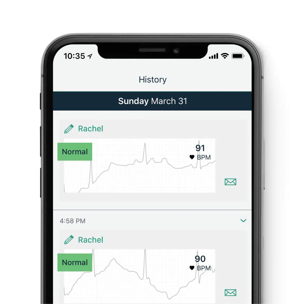 AliveCor KardiaMobile 6L | FDA-Cleared | Wireless 6-Lead EKG | Detects AFib or Normal Heart Rhythm in 30 Seconds