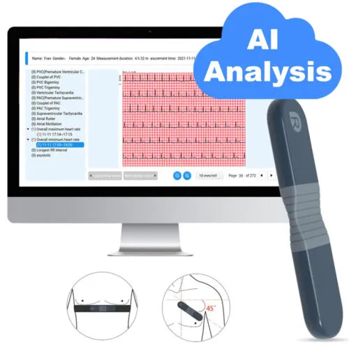 ECG Recorder with AI Analysis